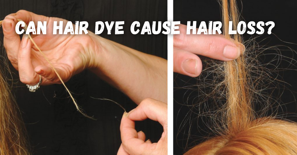 Can hair dye cause hair loss?